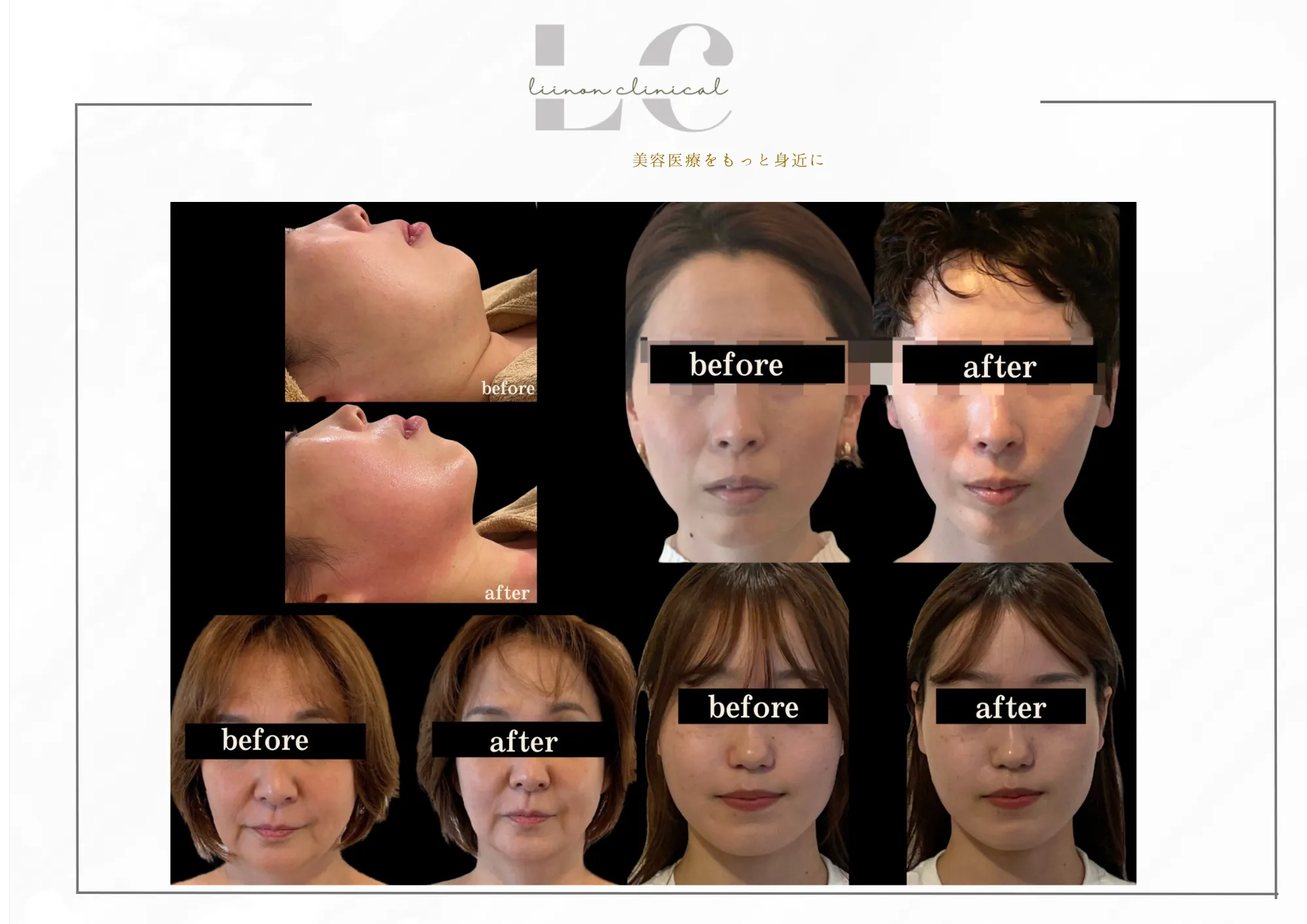 ビフォーアフターの画像